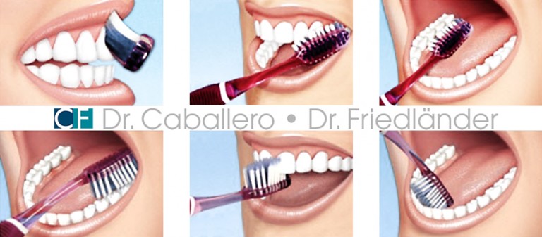 Técnicas De Cepillado Dental | Caballero Dental Clinic